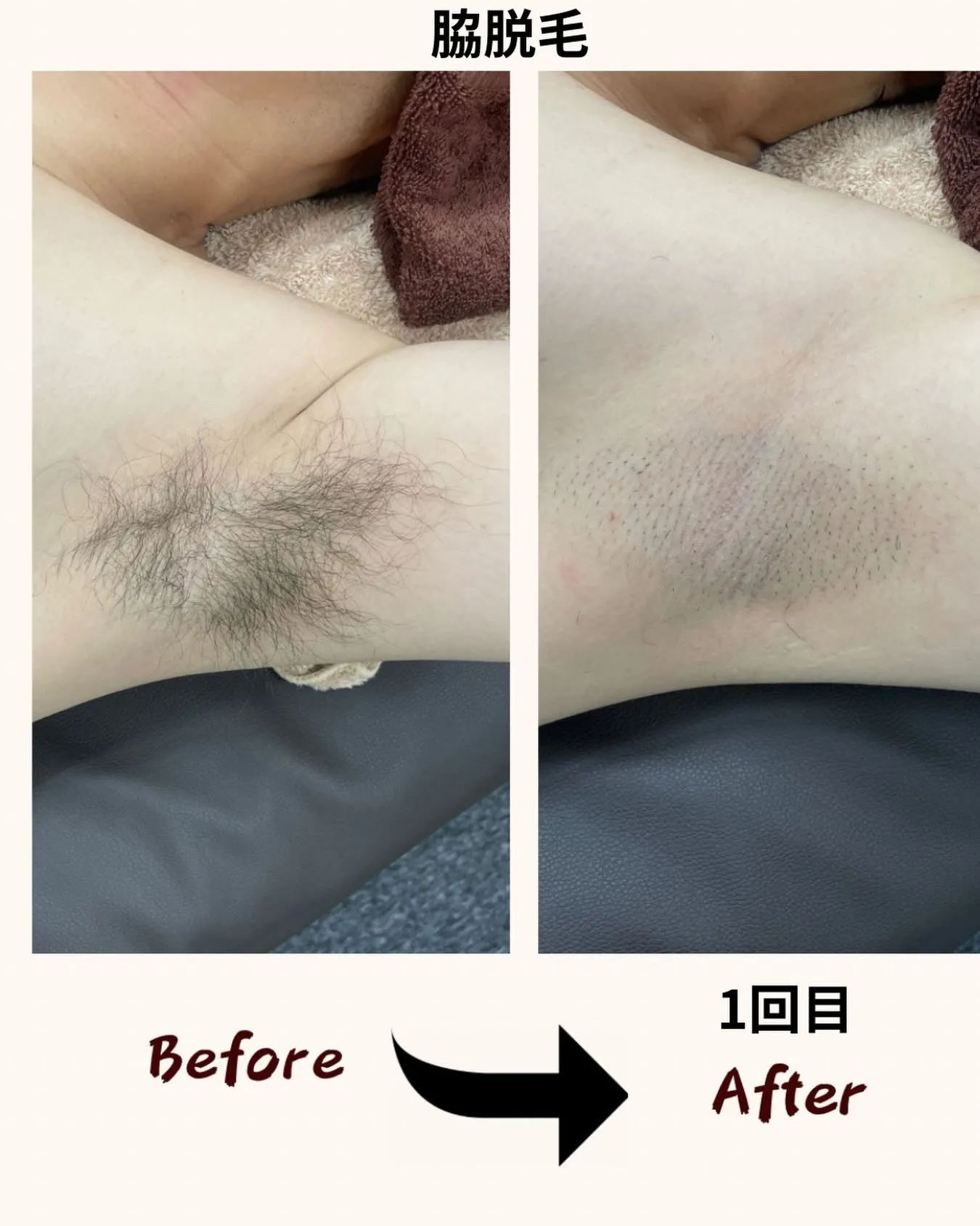 🌟 岐阜県・岐南町にある男性専用脱毛サロン「ラヴィアンローズ...