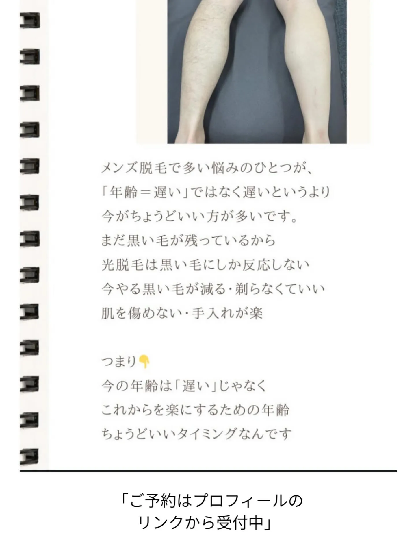 岐南町でメンズ全身脱毛を