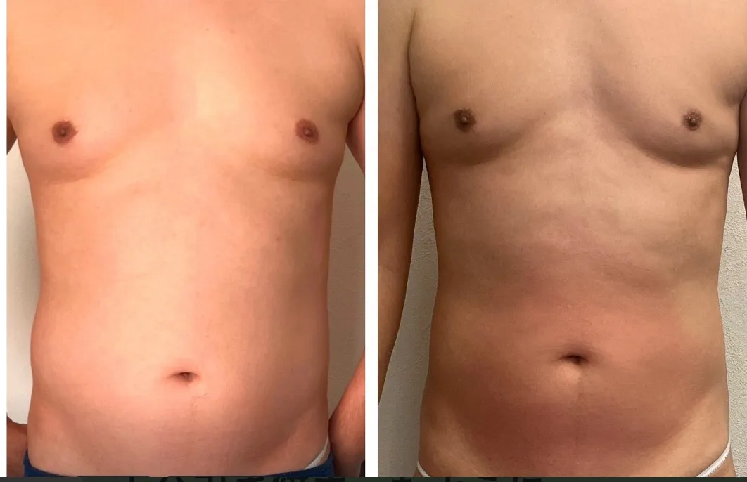 メンズエステでお腹ポッコリ男子が岐阜県羽島郡岐南町で理想ボディを目指す方法