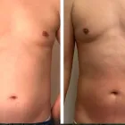 ダイエット
